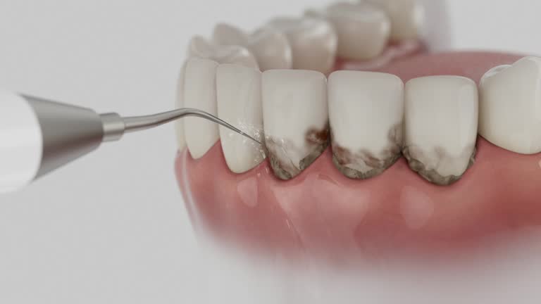 Reliable Dental contractor in Olivette, MO by Smile Center Dentistry